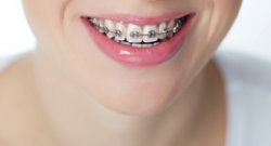 Ortodonti Tedavisinde Fırsat