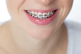 Ortodonti Tedavisinde Fırsat
